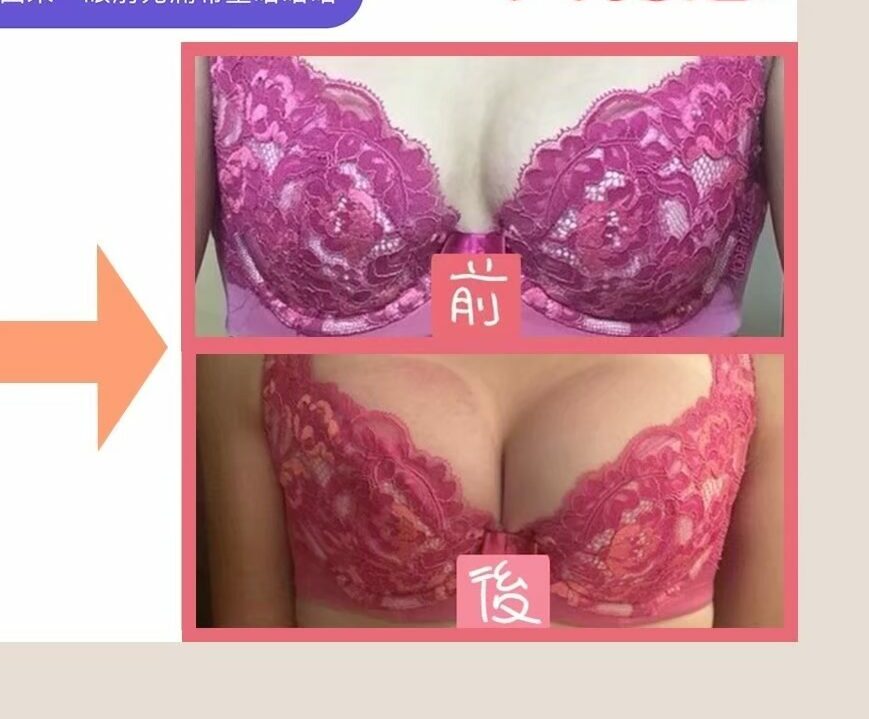 深v天使美胸按摩｜美胸見證